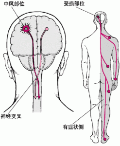 02 zhongfeng