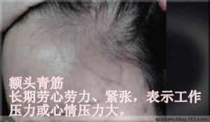 20150122 blue veins_forehead